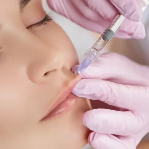 Botox + aumento de labios